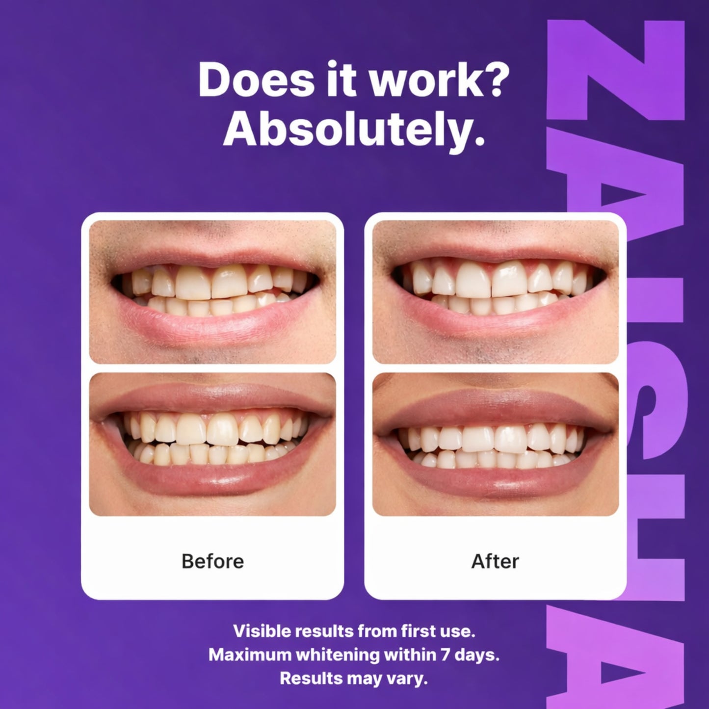 ZAISHA™ Purple Teeth Whitening Strips