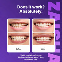 ZAISHA™ Purple Teeth Whitening Strips